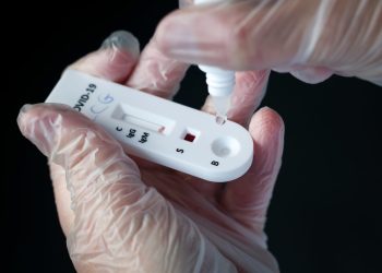 Estado do ES registra mais de 18 mil casos de Covid-19 em 24h