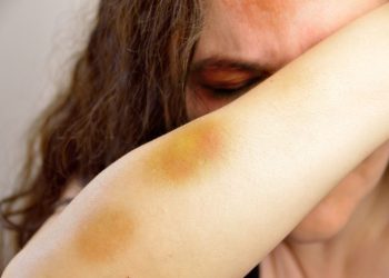 Violência doméstica no ES: denúncias aumentam 13,2% em 2024, com 195 ligações diárias para a PM