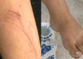 Jovem de 18 anos pula do segundo andar com duas crianças para escapar de marido armado