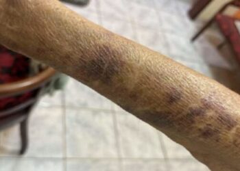 Homem é detido suspeito de violência contra a própria mãe no bairro Filomena
